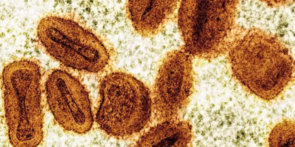 UK Reports New Case of Dangerous Mpox Variant Clade 1b