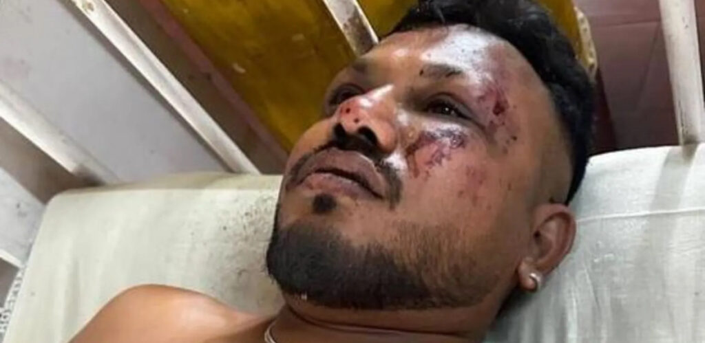 UK Man Survives Deadly Air India Plane Crash UK Man Survives Deadly Air India Plane Crash