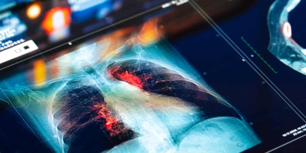 NHS Faces Legal Risk from AI Decisions NHS Faces Legal Risk from AI Decisions