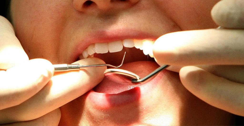 South West Faces NHS Dentist Crisis